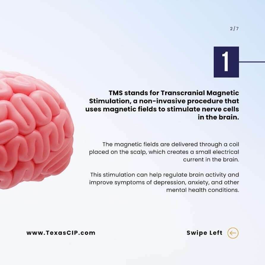 TMS